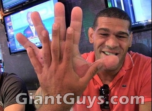 Antonio Silva Shows Off Huge Hand