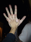 Gigantic hands