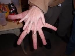 Unbelievably huge hand